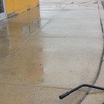 Gum Removal After Gum Removal After